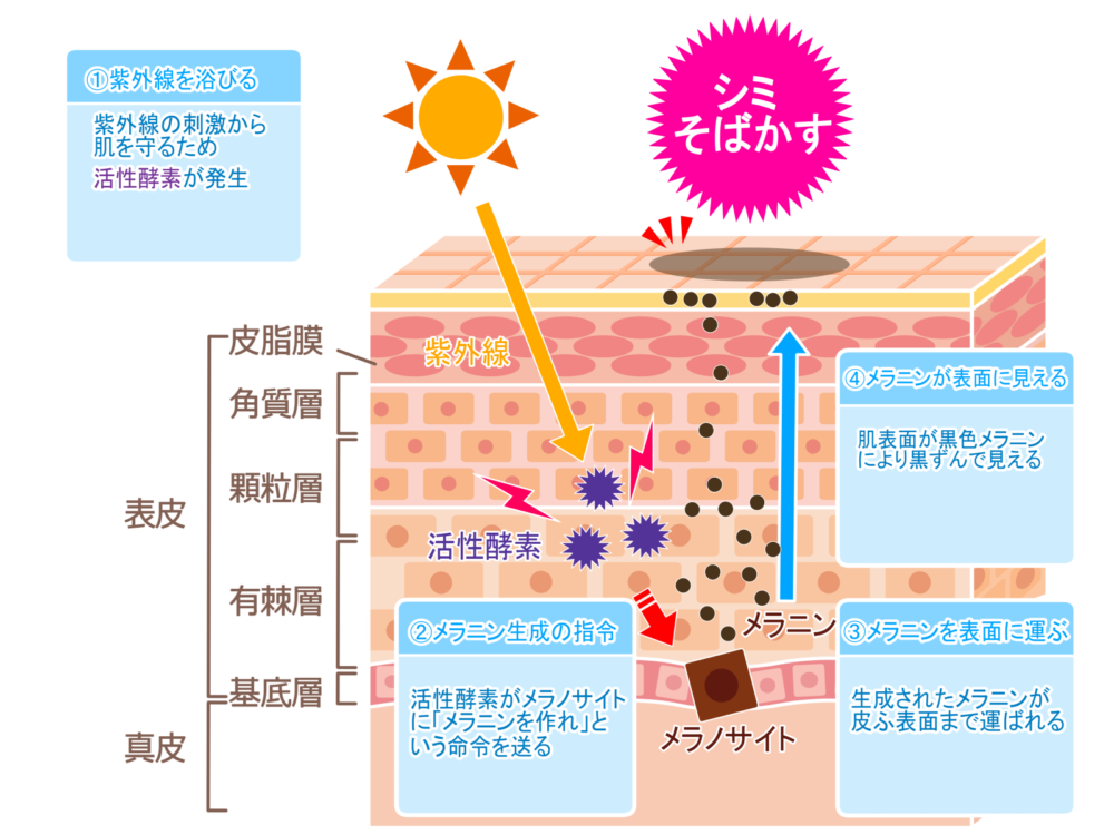 シミ・そばかすのメカニズム